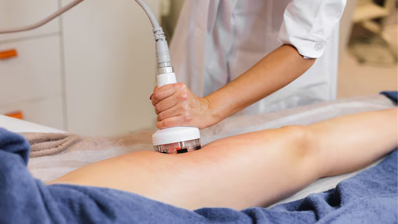 Cellulite treatment-4